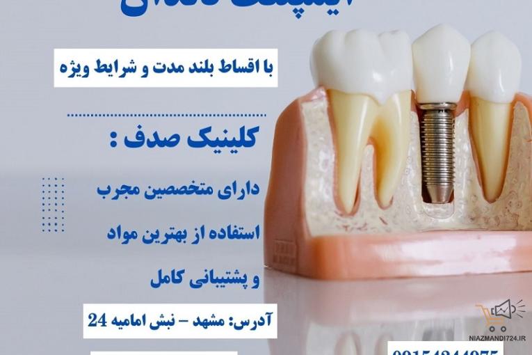 کاشت ایمپلنت بدون فشار مالی با اقساط بلند مدت