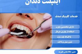 ایمپلنت دندان با کیفیت و عمر طولانی در مشهد