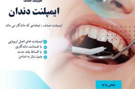 ایمپلنت ، بازسازی عملکرد طبیعی دندان ها با تکنولوژی روز